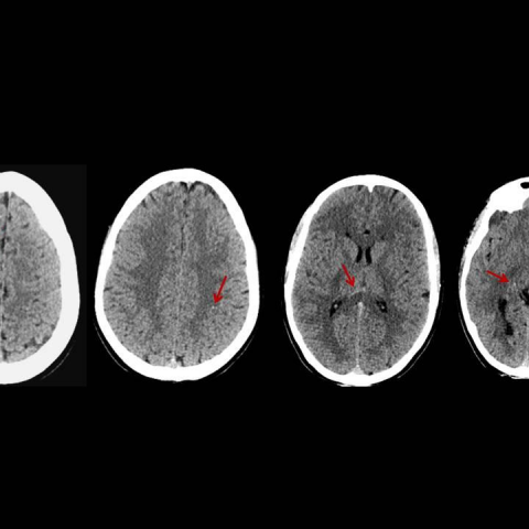 White Matter Imaging