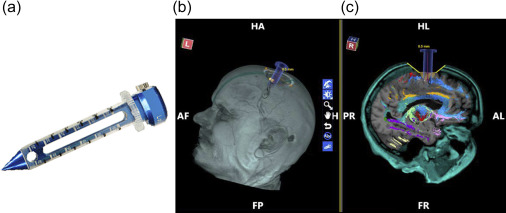 Precision in Image-Guided Procedures