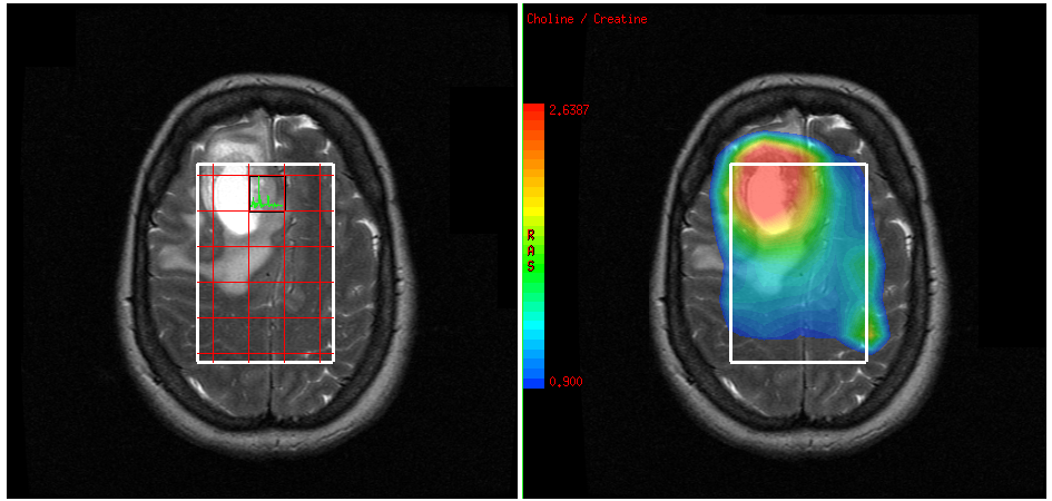 Perfusion Imaging