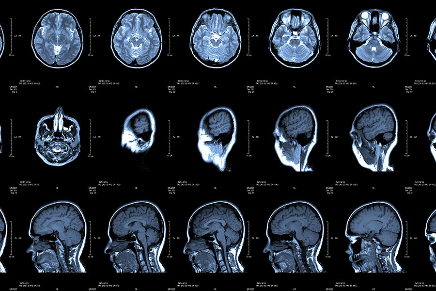 Why Neuroradiology?