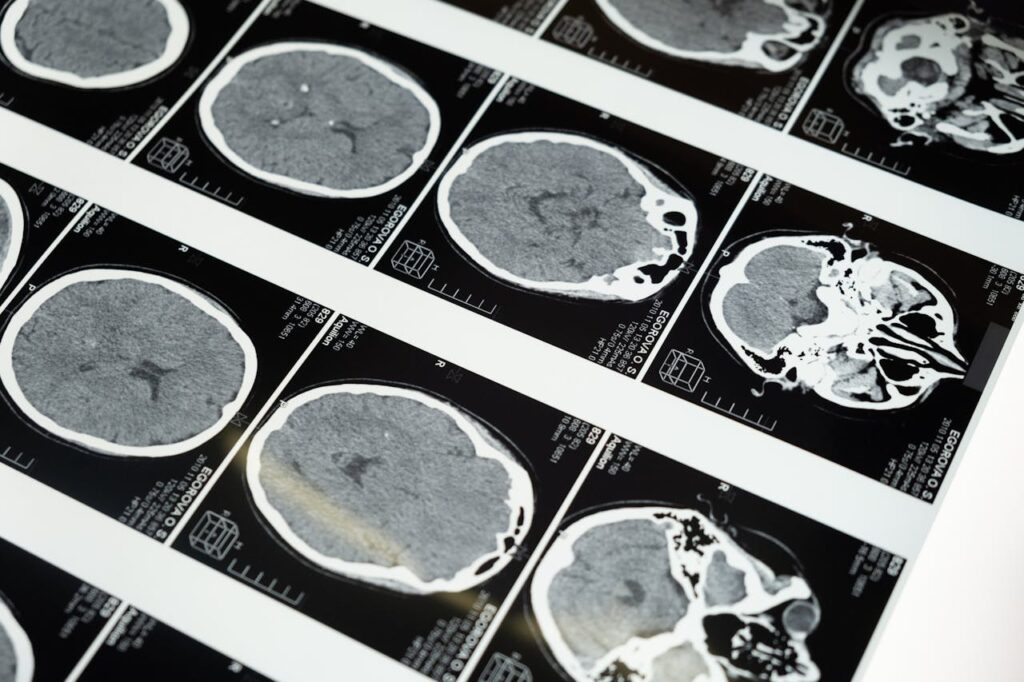 White Matter Imaging
