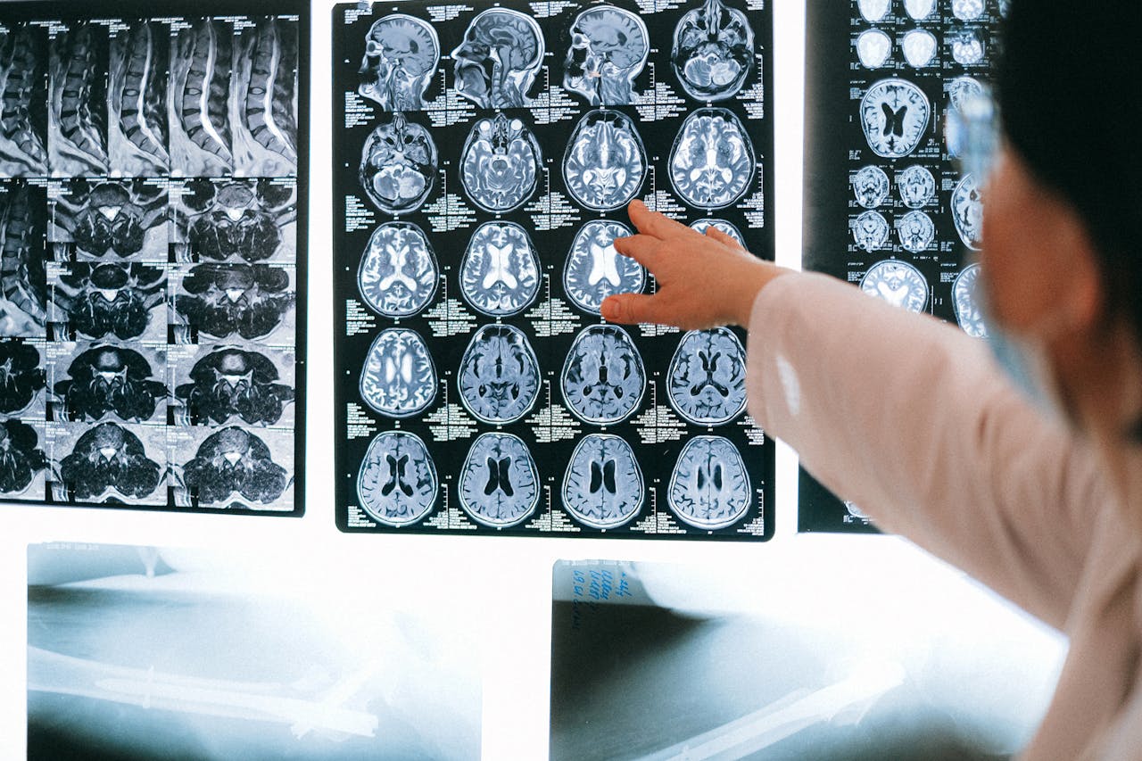 DTI Neuroimaging