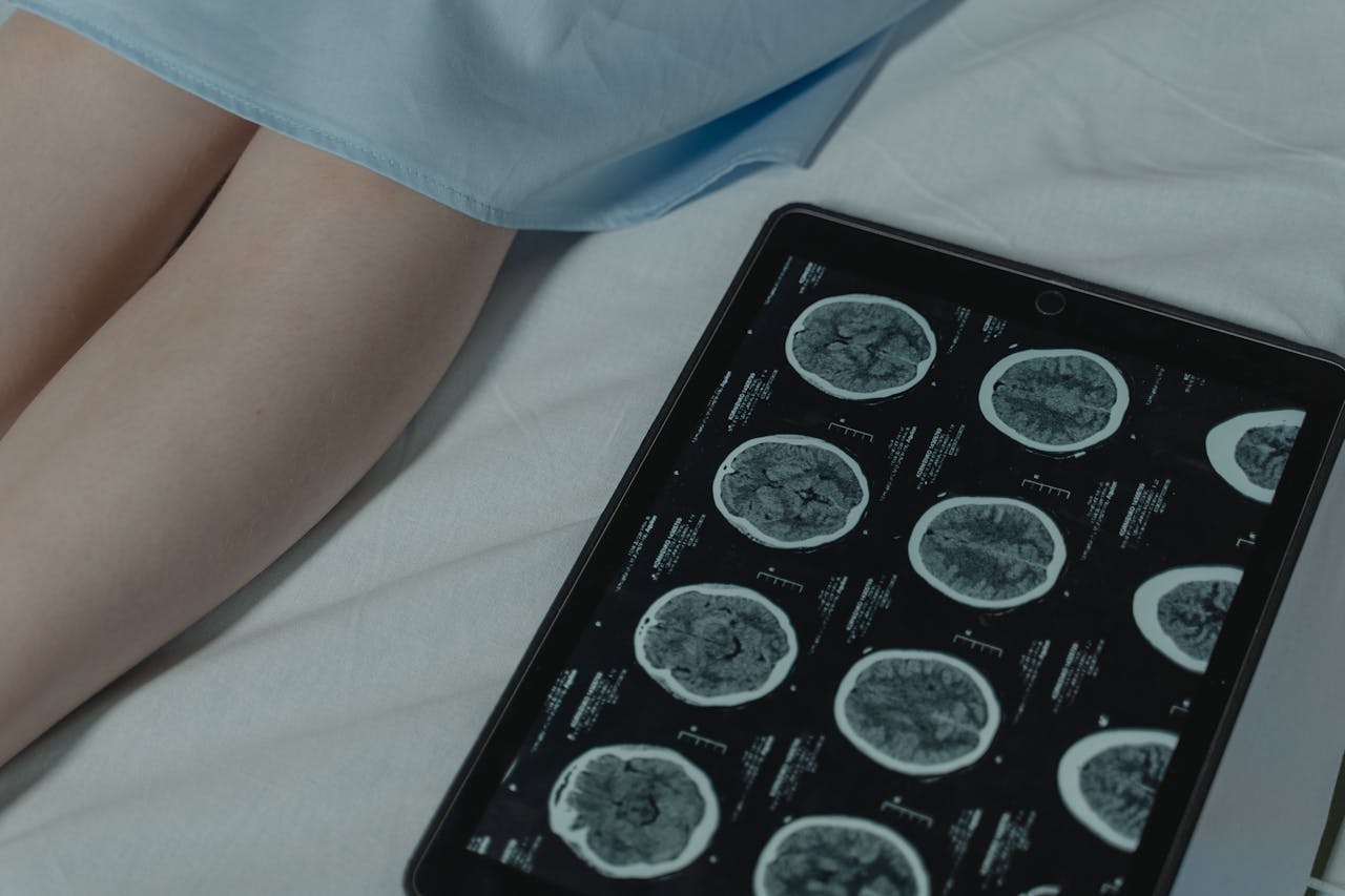 Forensic Neuroradiology for Imaging-Related Malpractice