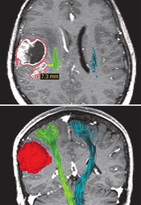 Precision in Image-Guided Procedures