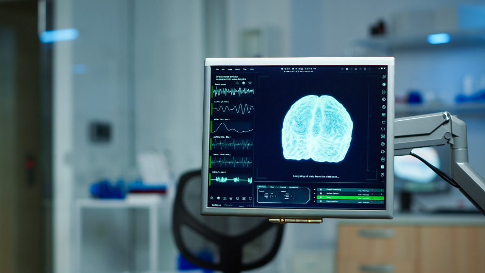Brain Mapping
